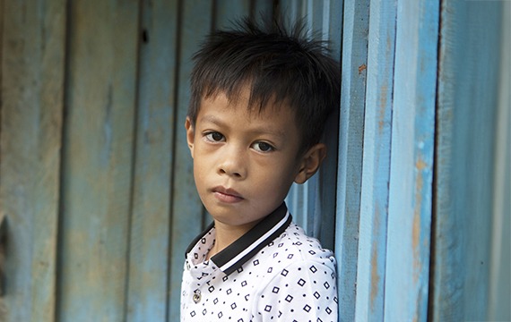 8-year-old John from the Philippines received sight-saving cataract surgery at a cbm-funded eye hospital.