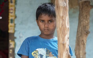 7-year-old Aanand from rural Nepal is blinded by cataracts.